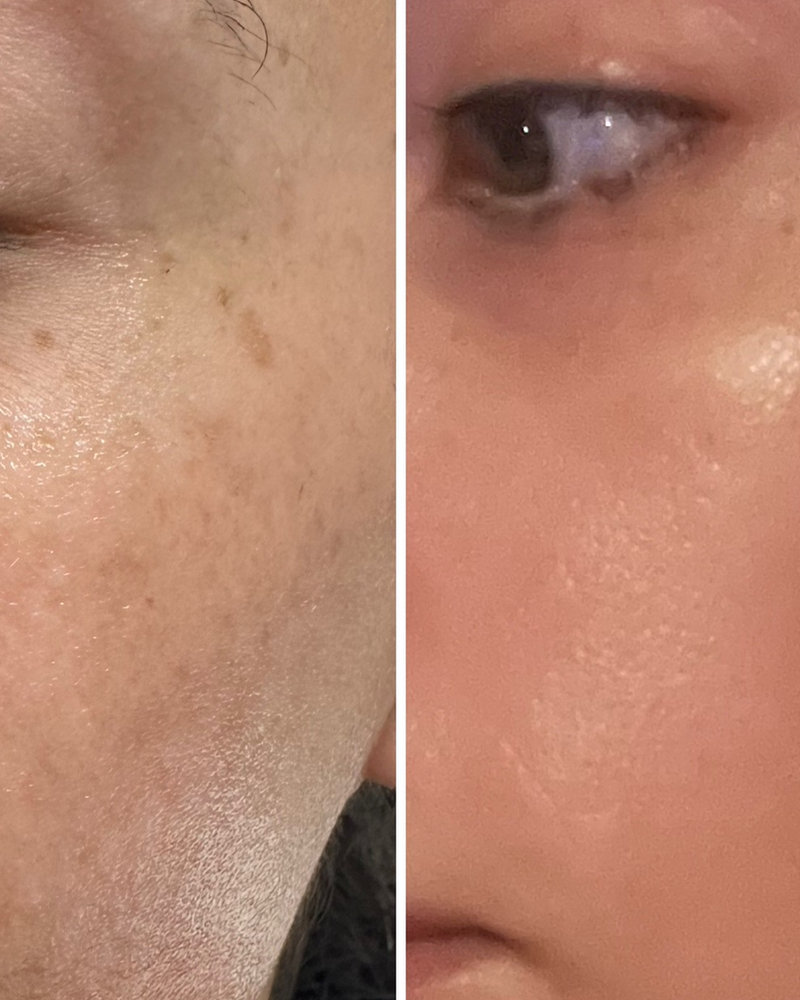 Revitalize Your Skin at North Shore Laser Center: Combating Sun Damage with Advanced Technology