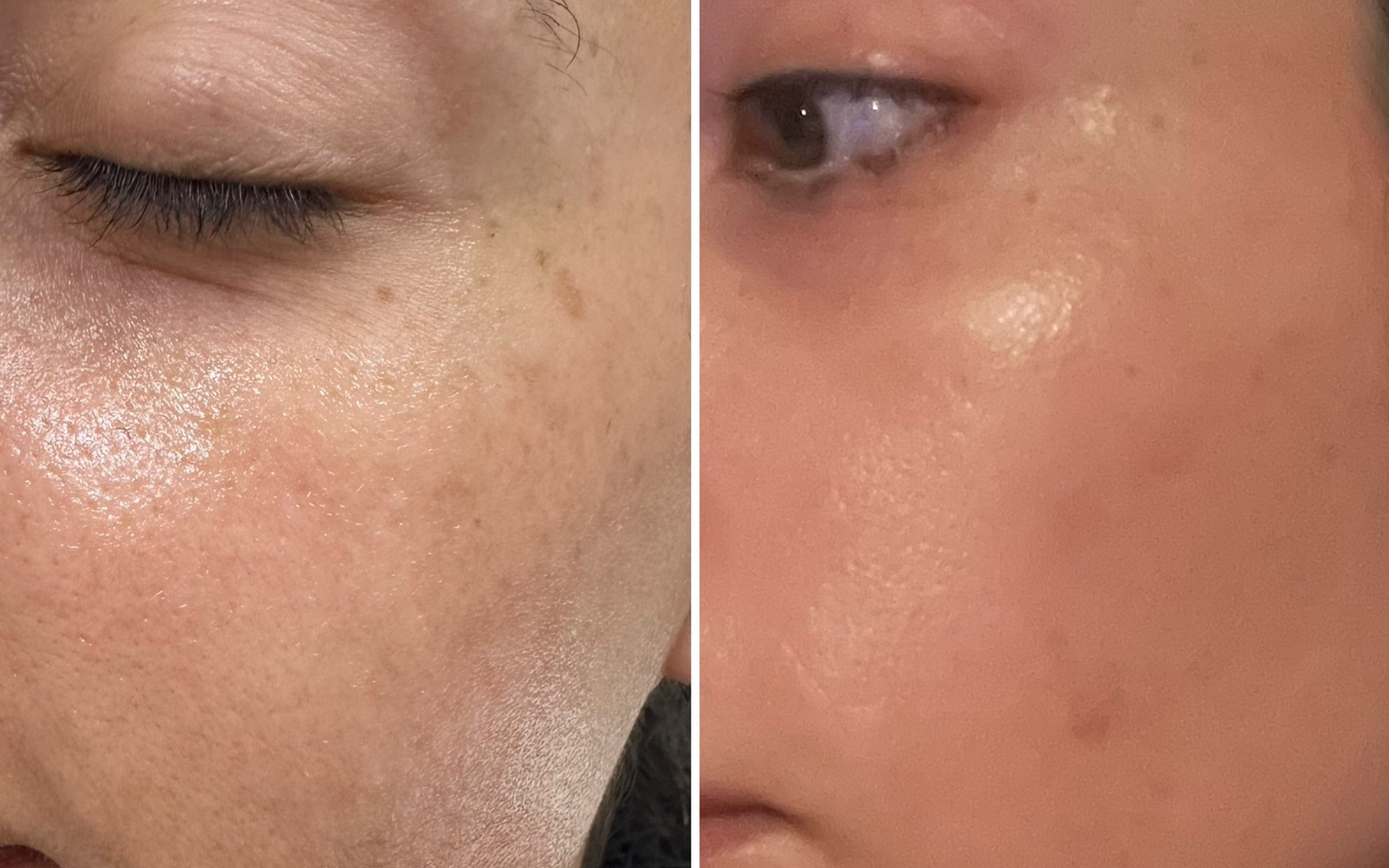 Revitalize Your Skin at North Shore Laser Center: Combating Sun Damage with Advanced Technology